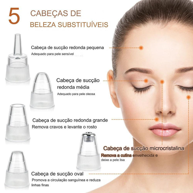 Removedor de Cravos Por Sucção a Vácuo