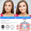 VivaSkin Pro - Massageador Facial Anti Rugas Rosto Pescoço com Laser Fotón de LED